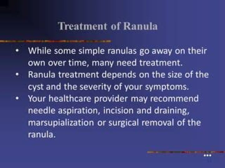 Do ranulas go away on their own?
