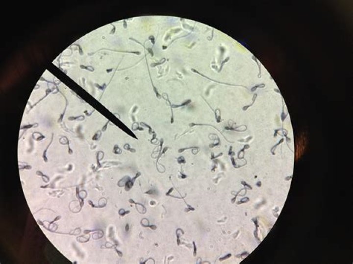 How do you find sperm with a black light?