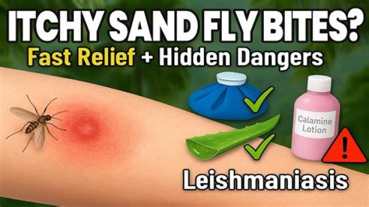 How to treat sandflies bite?
