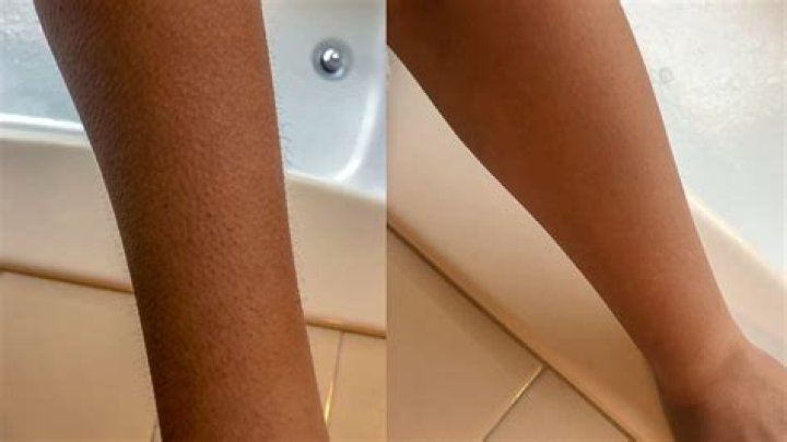 Is shaving your arms bad?