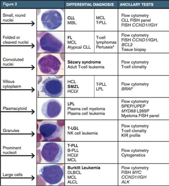 What does slight lymphocytosis mean?