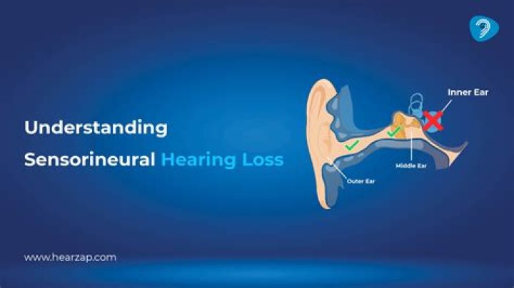 What sensorineural hearing loss sounds like?