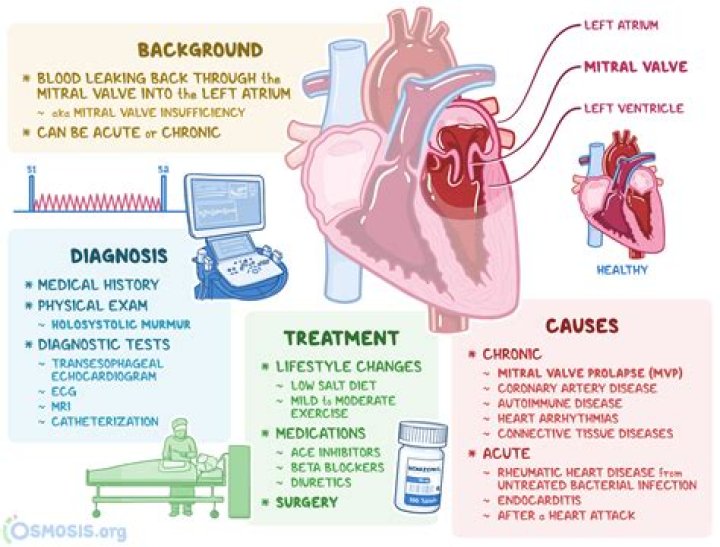 Where does mitral regurgitation radiate to?