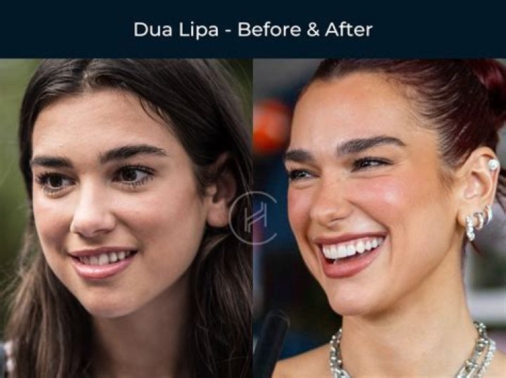 Who has a gap in their teeth?