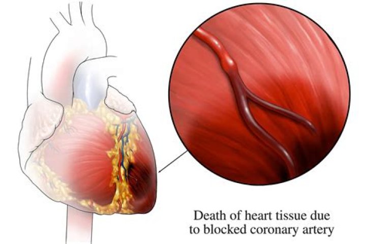Why is ischemia painful?